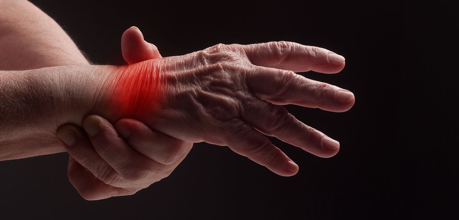 I sintomi iniziali dell’Artrite Reumatoide